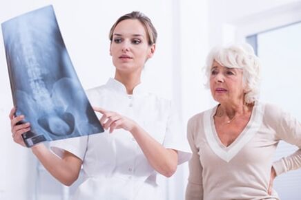 X izpien azterketa bizkarrezurreko osteokondrosia diagnostikatzeko modu informatiboa da