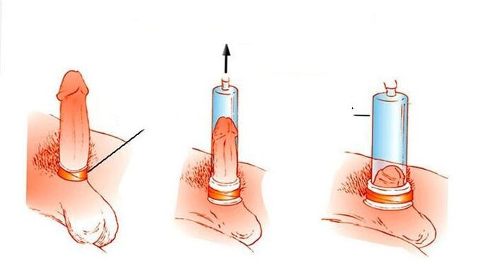 Huts-ponpa baten funtzionamendu-printzipioak