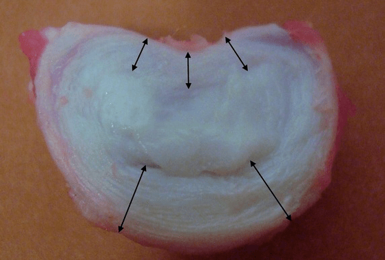 nolakoa da orno arteko disko bat