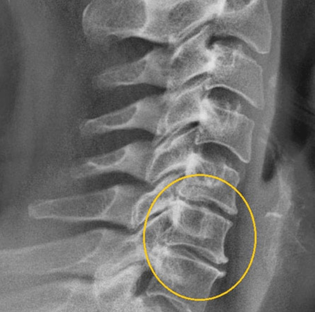 Argazki diagnostikoa